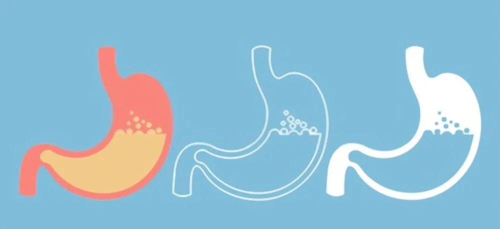 Comment Les Injections De Botox Gastrique Aident-Elles Les Gens à Perdre Du Poids ?