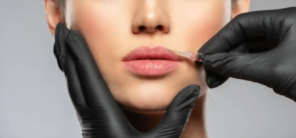 Le Lip Flip Est-il Une Meilleure Option Que Le Filler ?