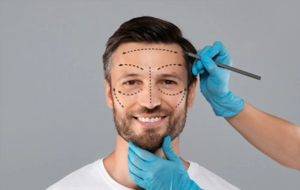 Lifting du visage pour hommes : 4 vérités que vous devez connaître