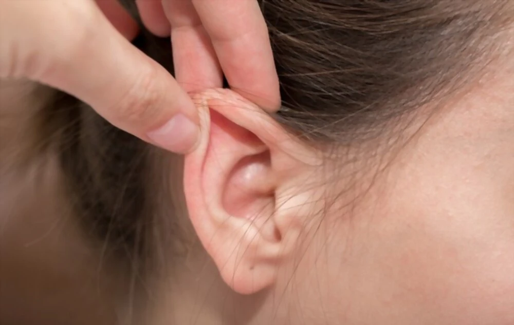 Otoplastie en Tunisie - Correction des oreilles décollées