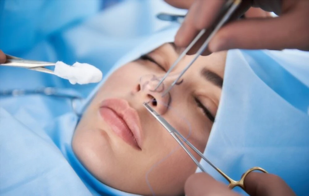 Résultat avant après rhinoplastie en Tunisie