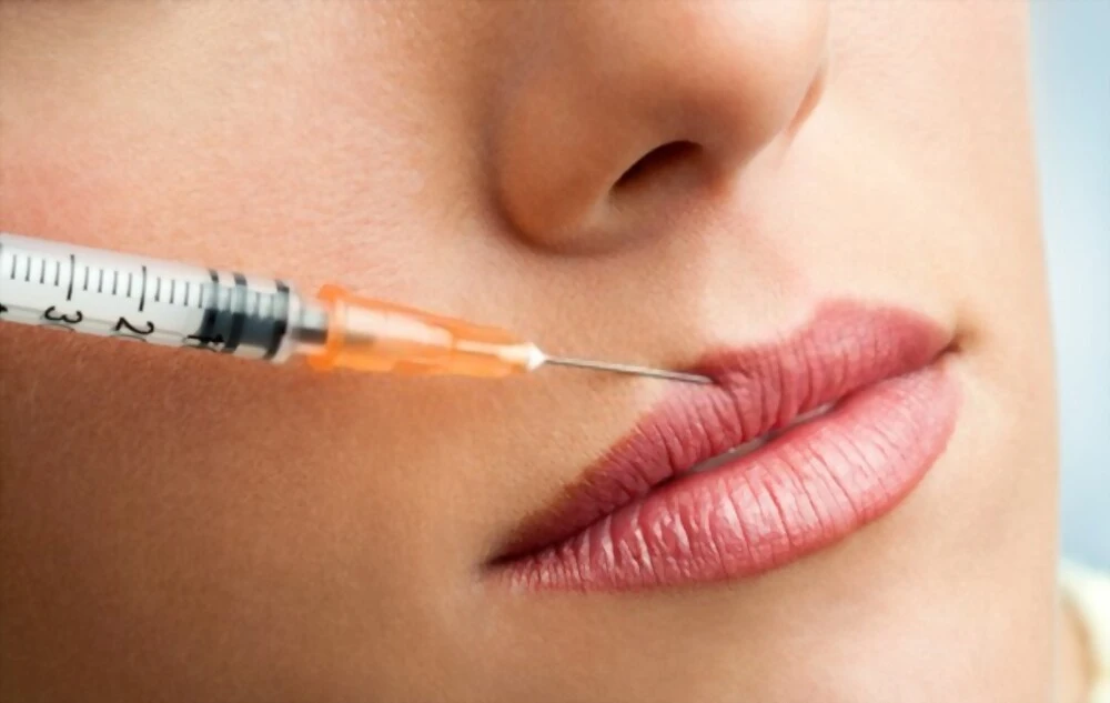 Injections de Botox en Tunisie pour atténuer les rides d’expression