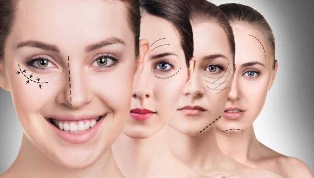 lifting du visage en Tunisie résultat naturel rajeunissement du visage