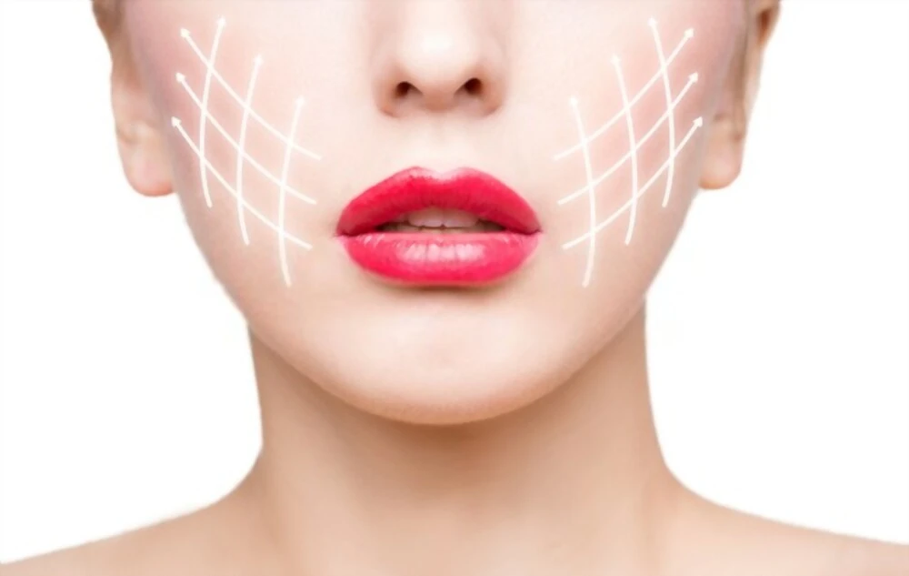 Lipofilling visage : 5 choses à savoir