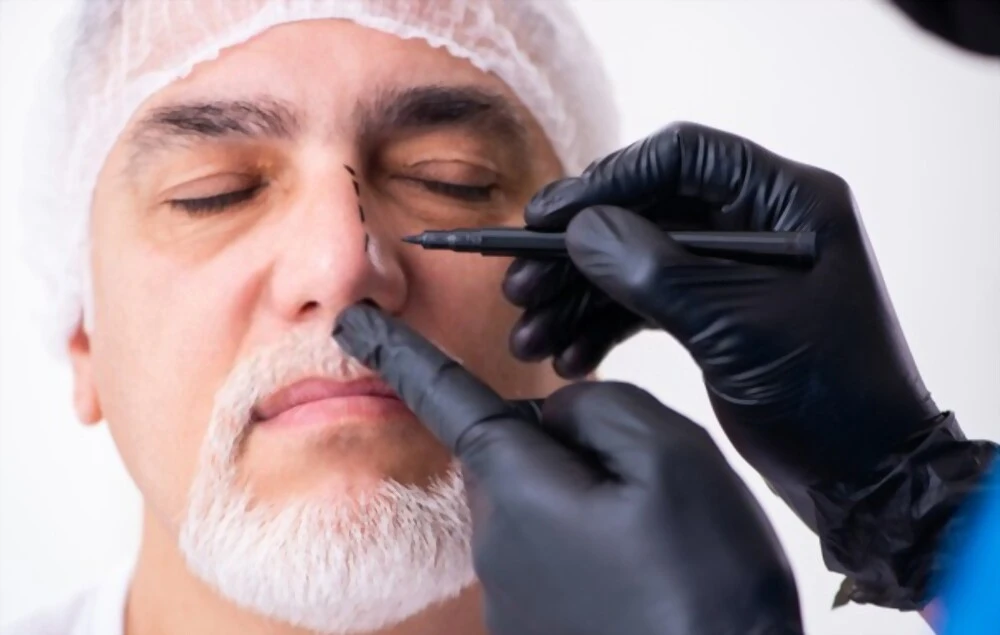Convalescence après une rhinoplastie