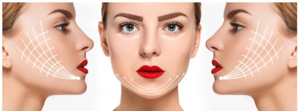 Tout savoir sur le traitement Strawberry Lift pour traiter les bajoues flasques et double menton