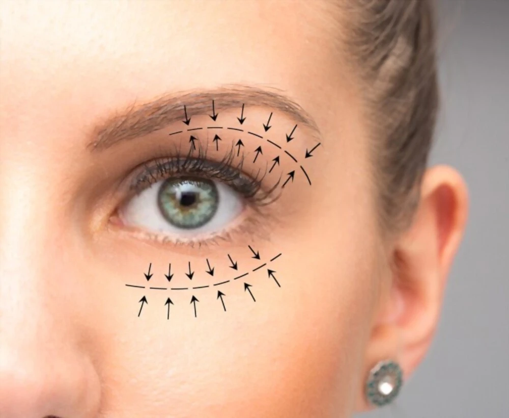 Tout ce que vous devez savoir sur la blépharoplastie, la chirurgie des paupières