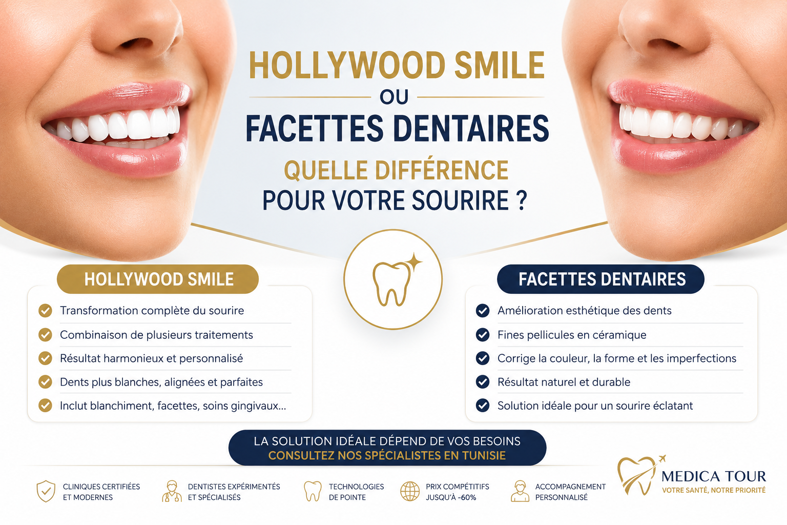 Hollywood Smile ou facettes dentaires : quelle différence pour votre sourire ?
